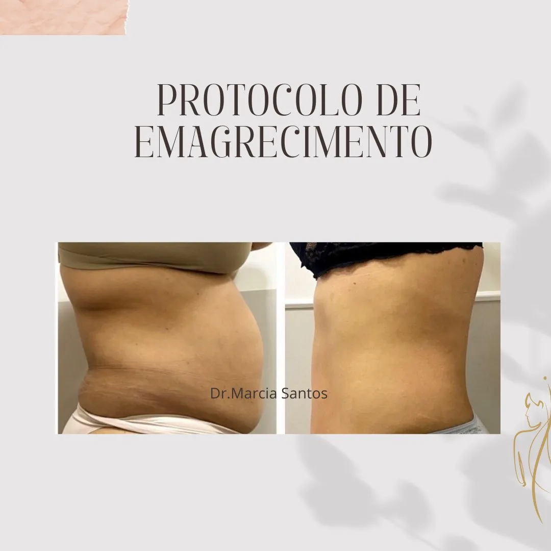 Resultado protocolo de emagrecimento